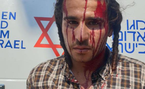 עשרות ערבים התעמתו עם יהודים בשומרון, 4 נפצעו