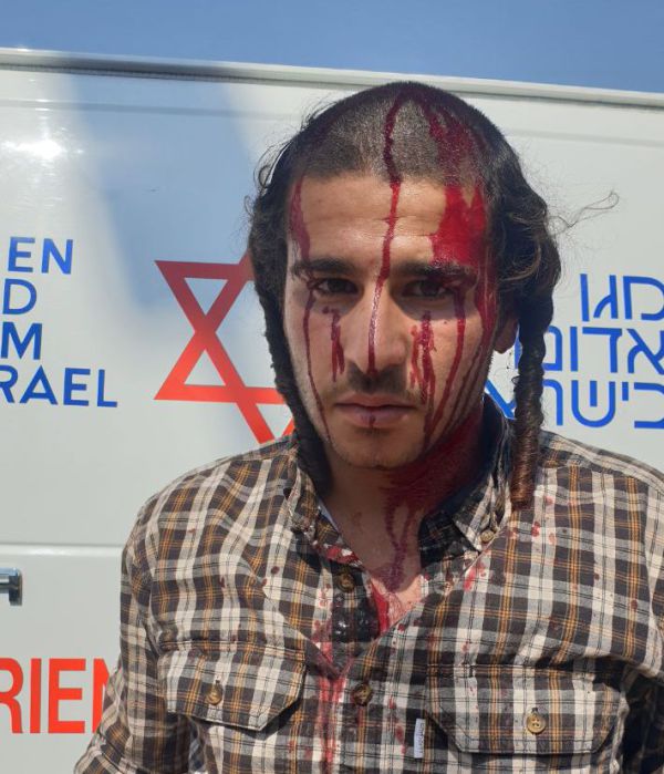 עשרות ערבים התעמתו עם יהודים בשומרון, 4 נפצעו