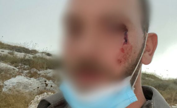 המשטרה: יהודים תקפו לוחמי מג"ב בסמוך ליצהר