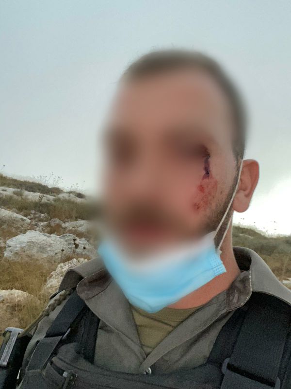 המשטרה: יהודים תקפו לוחמי מג"ב בסמוך ליצהר