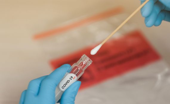 אג'נדה 21 תיאורית הקונספירציה של הקורונה