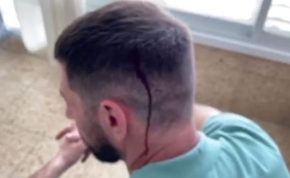 חיים אתגר הותקף בראשו במהלך צילומי 'יצאת צדיק'