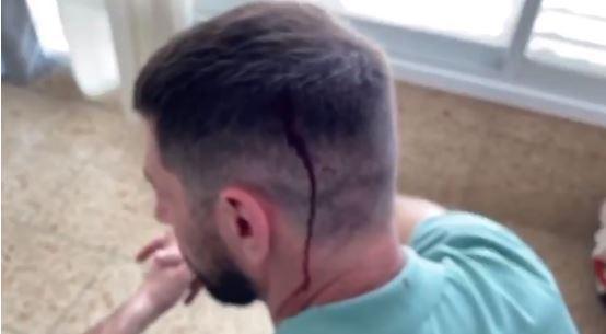 חיים אתגר הותקף בראשו במהלך צילומי 'יצאת צדיק'