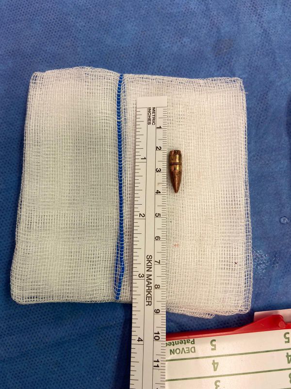 הרופאים הצילו בן 9 מראס אל עמוד שנורה בראשו