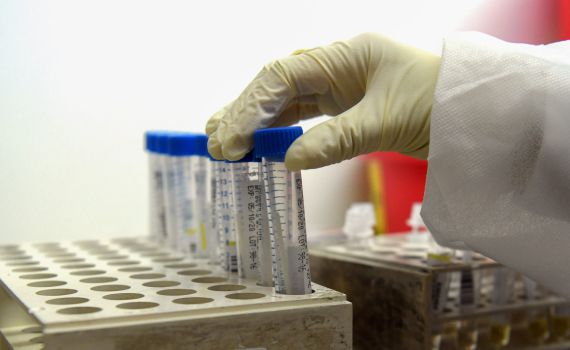 יום שני ברצף: שיעור החיוביים מעל ל-3%