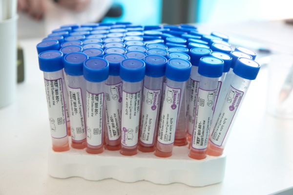 ביממה האחרונה: שיא במספר הנדבקים והנבדקים