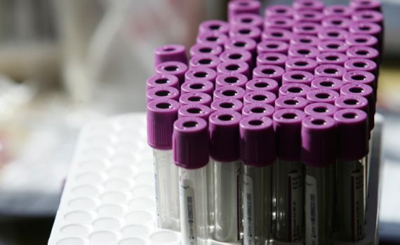 לפני "40 יום": בדיקה גנטית כבר בשבוע ה-7 להריון