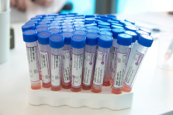 טיפול ניסיוני בהדסה: 5 במצב קשה החלימו מקורונה