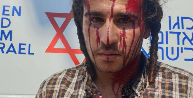 ניצל מהמון ערבי שניסה לבצע לינץ' – ויעמוד לדין