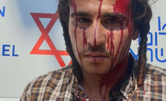 ניצל מהמון ערבי שניסה לבצע לינץ' – ויעמוד לדין