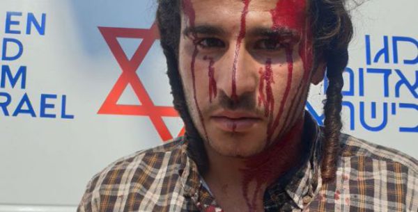 ניצל מהמון ערבי שניסה לבצע לינץ' – ויעמוד לדין