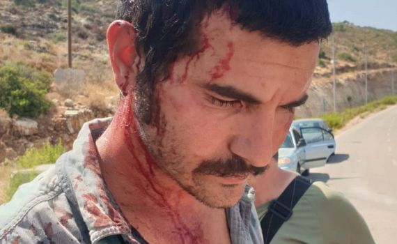 רשמית: כתב אישום נגד החקלאי שעבר לינץ'