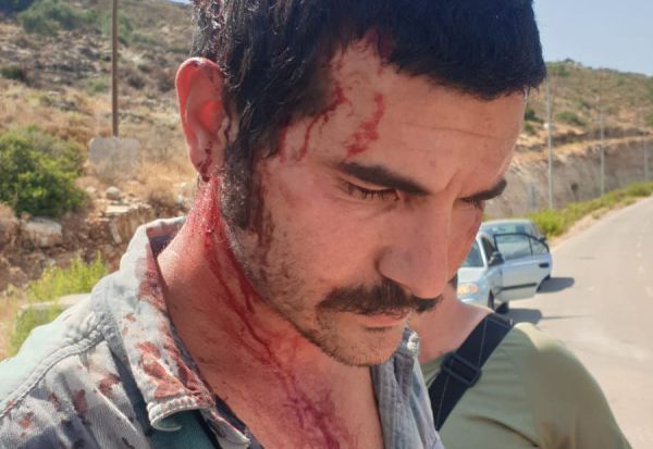 רשמית: כתב אישום נגד החקלאי שעבר לינץ'