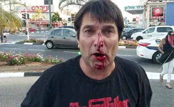 מעצר בית למפגין שתקף הערב פעיל ימין