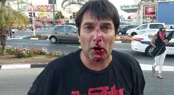 מעצר בית למפגין שתקף הערב פעיל ימין