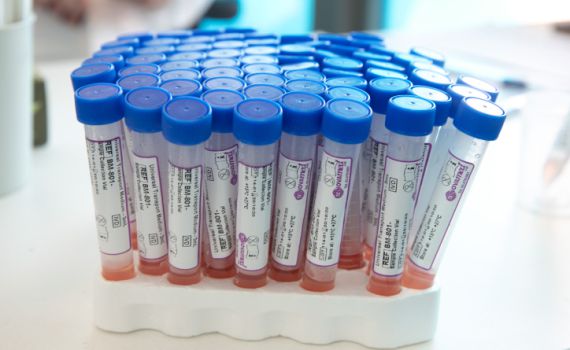 אחוז הבדיקות החיוביות: הנמוך בשבועיים האחרונים