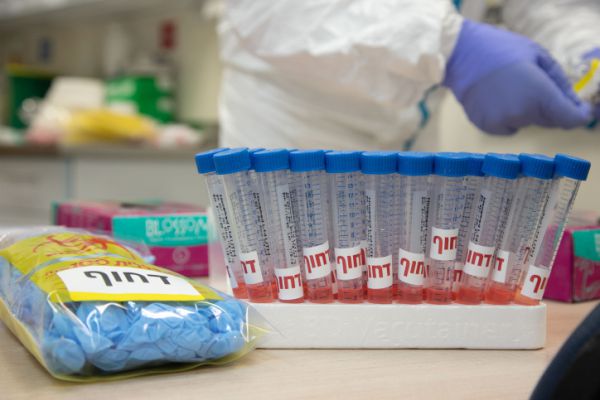 אחוז הבדיקות החיוביות – הנמוך מזה 3 חודשים