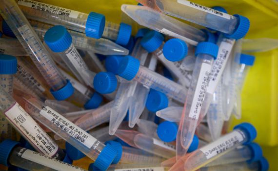 פחות מ-2000 מאומתים חדשים ביממה האחרונה