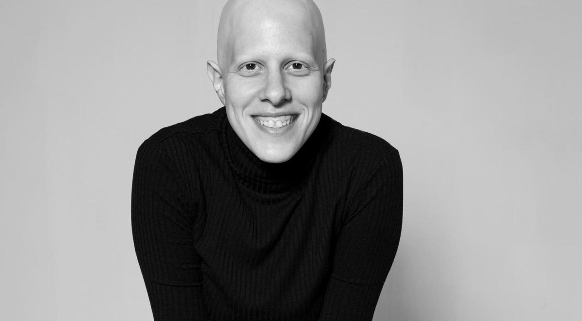 יום הקרחת הבינלאומי: רחלי בדנר חדד בטור אישי