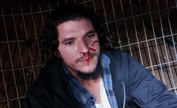 שוב אלימות ביצהר: ג'יפ נגח ברכב, שוטרים תקפו תושב