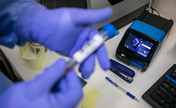 מספר המאומתים – הגבוה ביותר ב-10 הימים האחרונים