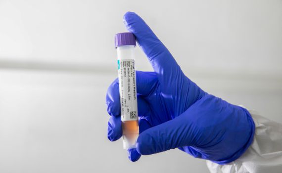 אלה הערים בהן אותרה המוטציה הבריטית בישראל