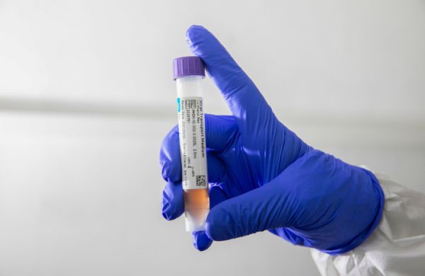 אלה הערים בהן אותרה המוטציה הבריטית בישראל