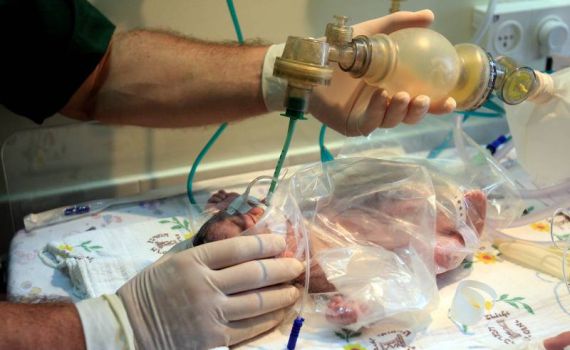 קורונה: בבית החולים הדסה נפטר תינוק בן חודשיים