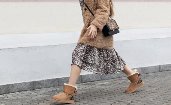 אזעקת טרנד: הלהיט התורן מגפיים במילוי צמר כבשים