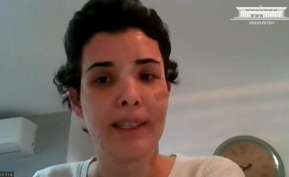 שירה איסקוב: "החשש של הקורבן, לא מעניין אותם"