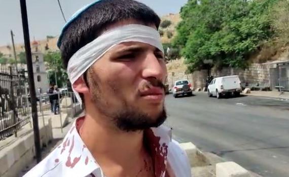 הנהג המותקף: חטפנו אבנים, בעיטות וגז פלפל לאוטו