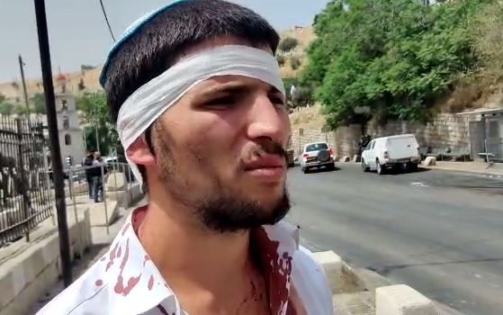 הנהג המותקף: חטפנו אבנים, בעיטות וגז פלפל לאוטו