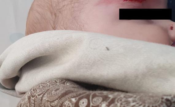 נתפסו הערבים שניסו לרצוח תינוקת בת 7 חודשים