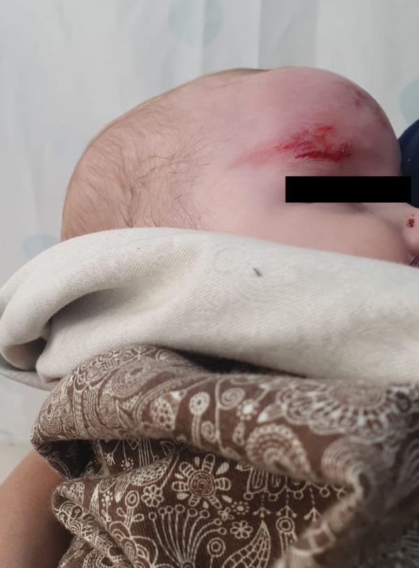 הורשעו 2 הערבים שפצעו תינוקת באבן ב'שומר חומות'