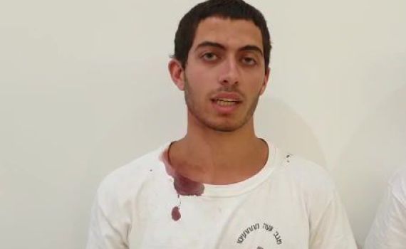 חבריו של יהודה גואטה ז"ל חטפו אבנים ומקלות בירושלים