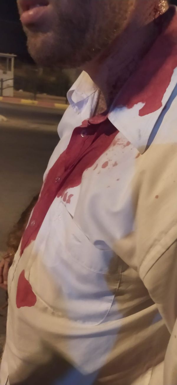 עשרות רעולי פנים רגמו באבנים משפחה בשומרון