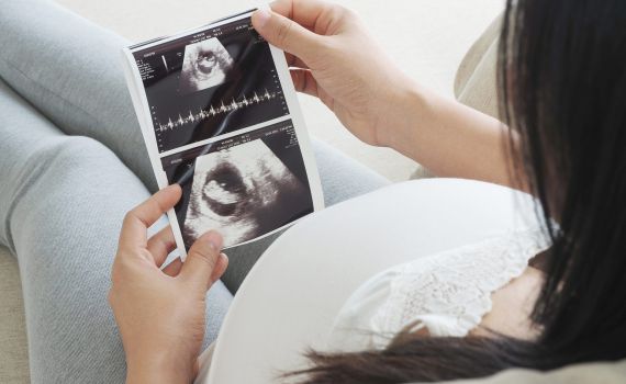 הלם: עברה הפרייה וגילתה כי העובר שייך לזוג אחר