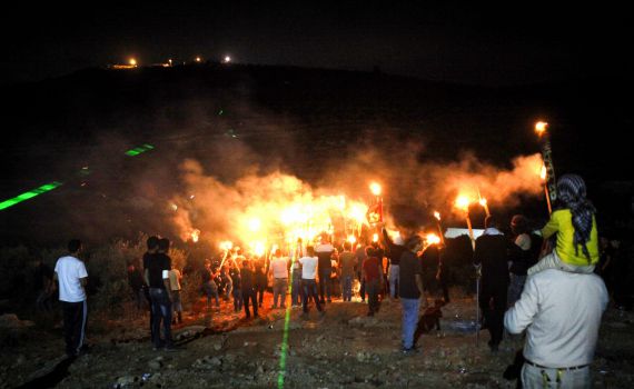 יהודי נפצע מלינץ' של ערבים בכפר התימנים
