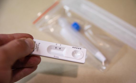 ראש מטה בריאות הציבור: "יעילות האנטיגן סביב 80%"