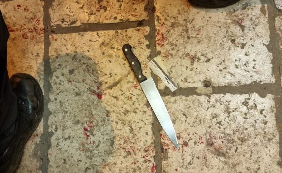 הלילה: פיגוע דקירה בעיר העתיקה בירושלים