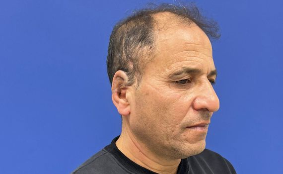 שערי צדק: הדפיסו אוזן והשתילו בטכנולוגיה חדישה