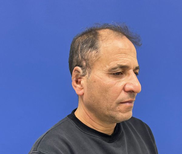 שערי צדק: הדפיסו אוזן והשתילו בטכנולוגיה חדישה