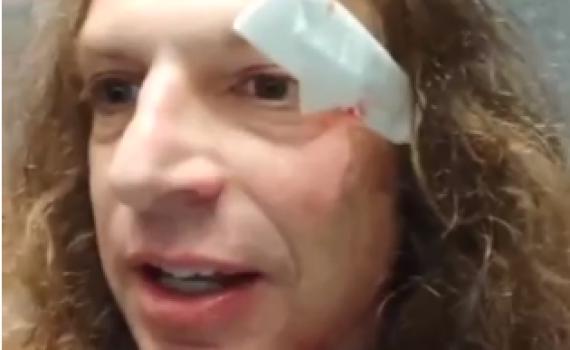 נעצר חשוד בתקיפה של אמיר חצרוני