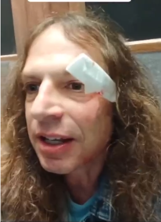 נעצר חשוד בתקיפה של אמיר חצרוני