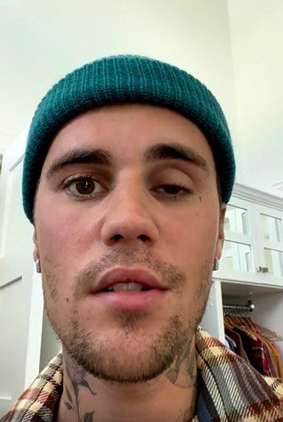 ג'סטין ביבר חושף כי חצי מפניו משותקות