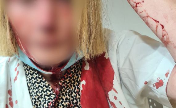 באר יעקב: הוארך מעצר החשוד בתקיפת הרופאה