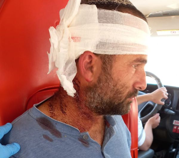 לינץ' בהר חברון: פלסטינים היכו נהג יהודי במוטות ואבנים