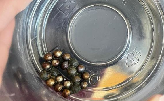 בן 8 בלע 20 מגנטים ועבר ניתוח להוצאתם מגופו