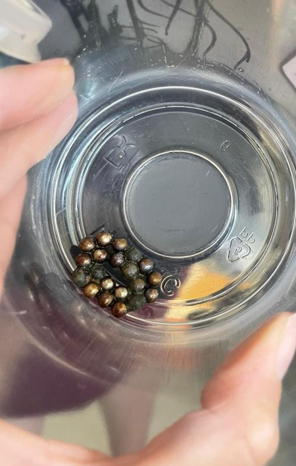 בן 8 בלע 20 מגנטים ועבר ניתוח להוצאתם מגופו