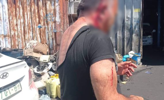 יהודי נשדד והותקף בתוך הכפר עזון שבשומרון